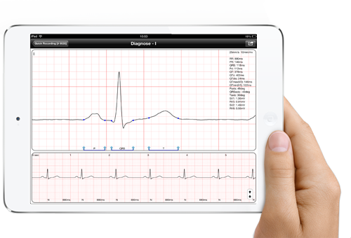 Professional Digital Electrocardiograph iCV200BLE for iOS and Mac, Electrocardiograph - Medical equipment / Equipo medico - Mediventa USA