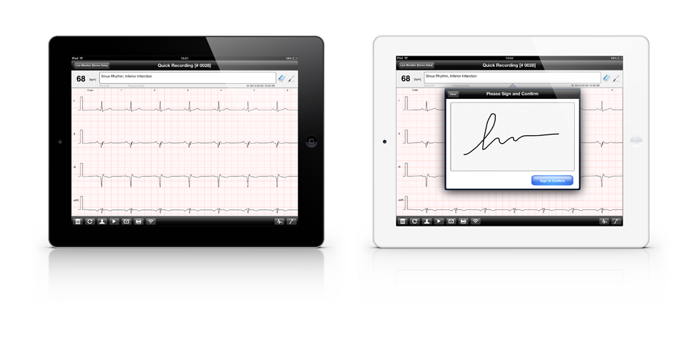 iCV200BLE Electrocardiograph for Ipad, Electrocardiograph - Medical equipment / Equipo medico - Mediventa USA
